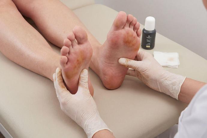 Propolis Lösung bei Nagelpflege – Fußpflege von Remmele’s Propolis