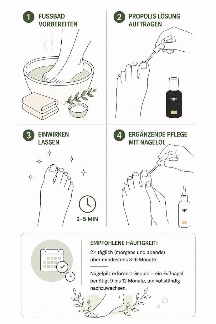Nagelpilz behandeln – so geht's Schritt für Schritt Schritt für Schritt grfaik fuer nagelpilz behandeln