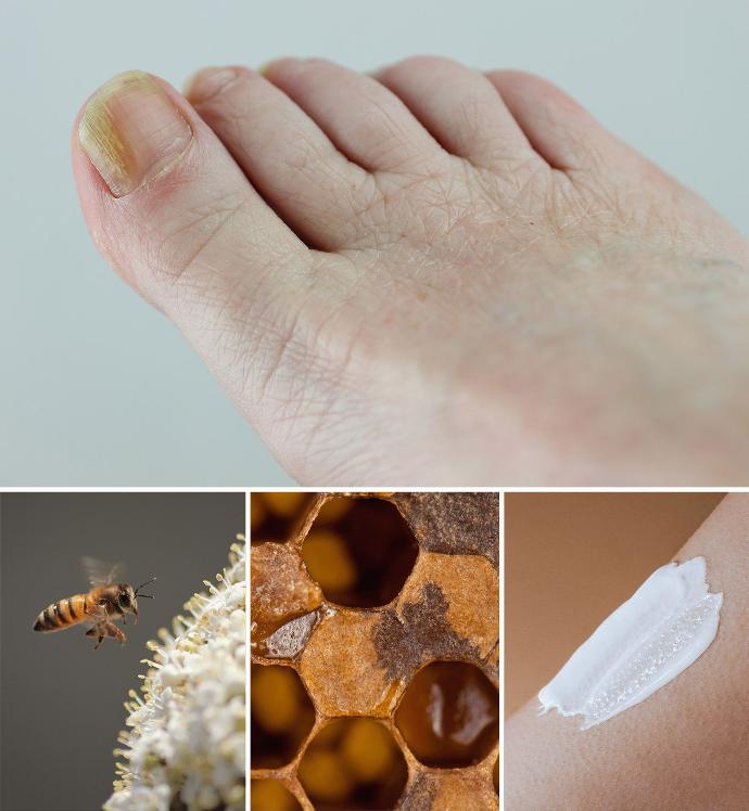 bild-mit-nagelpilz-bienen-waben-und-propolis-creme-auf-der-haut